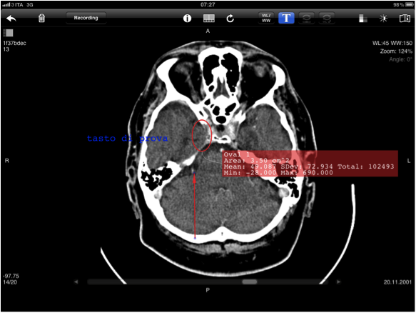 Aycan Mobile per iPad