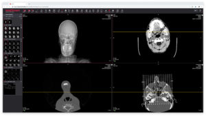medDream X è una soluzione web pensata per la refertazione e visualizzazione di immagini medicali