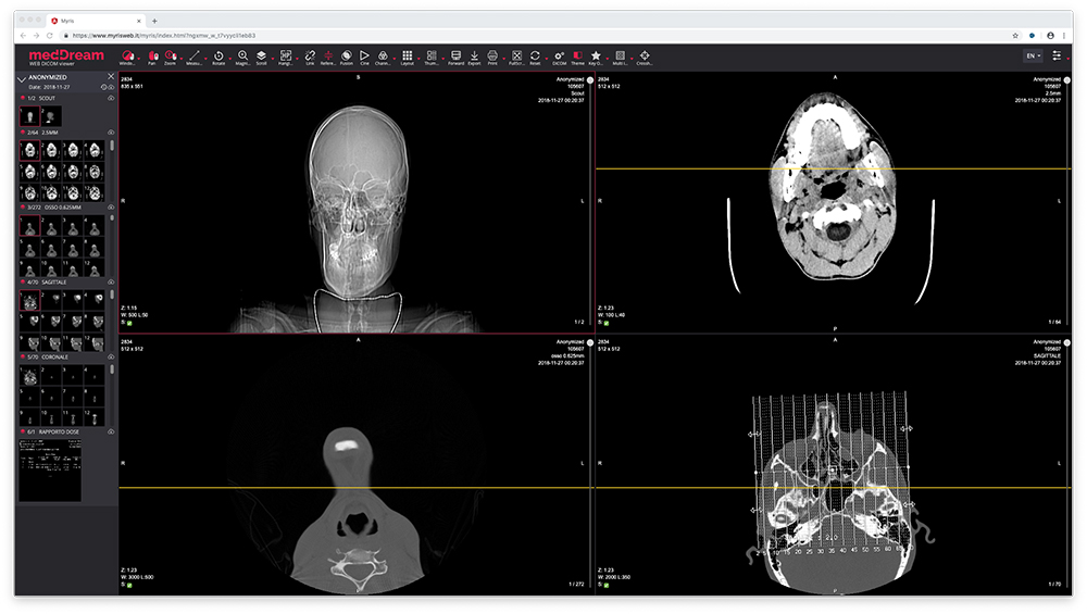 medDream X è una soluzione web pensata per la refertazione e visualizzazione di immagini medicali
